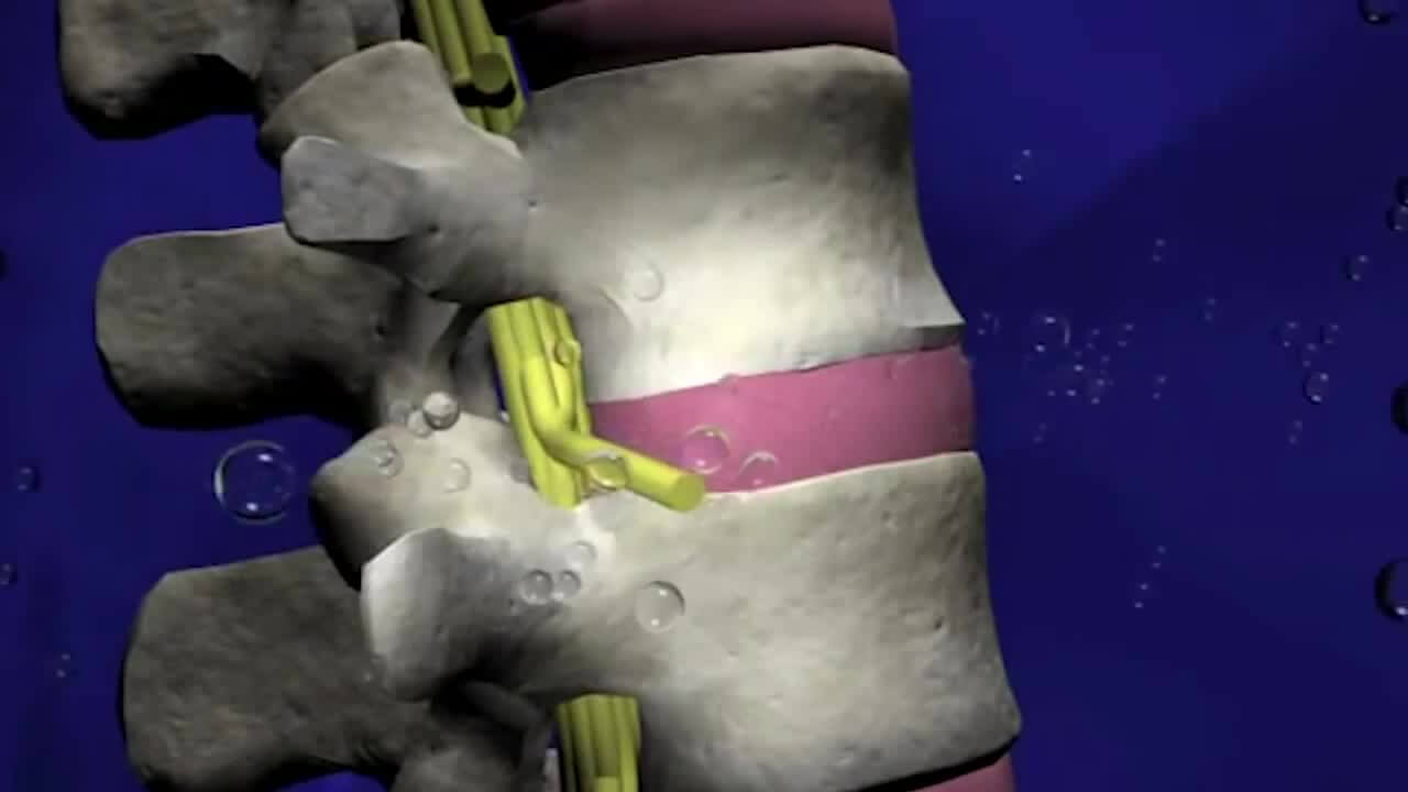 Курс MBST-терапии "Максимум"