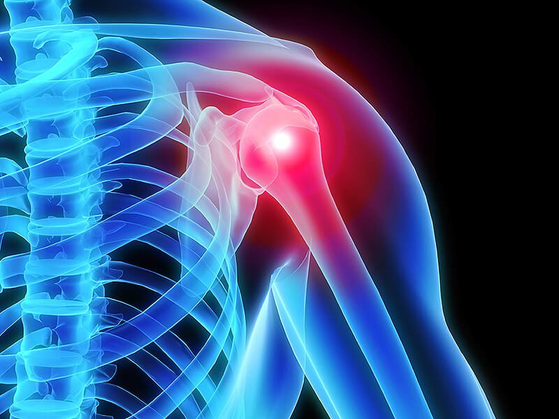 Курс MBST-терапии "Артроз сустава стандарт"