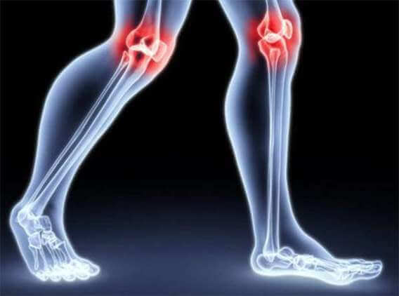 Курс MBST-терапии "Артроз двух суставов максимум"